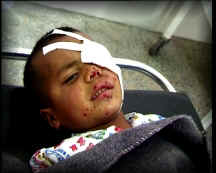 Afghanistan - Collateral Damages